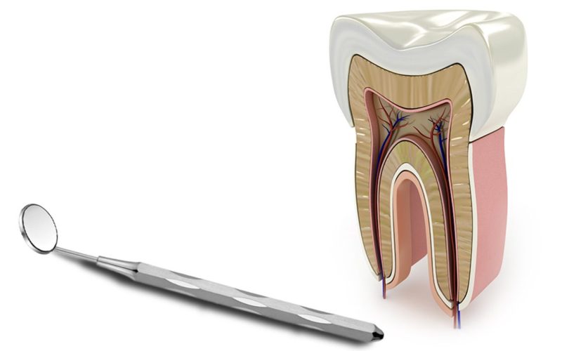 Лечение каналов. Advanced Endodontics. «Alfa Endodontic Concepts». Endodontics Marco.